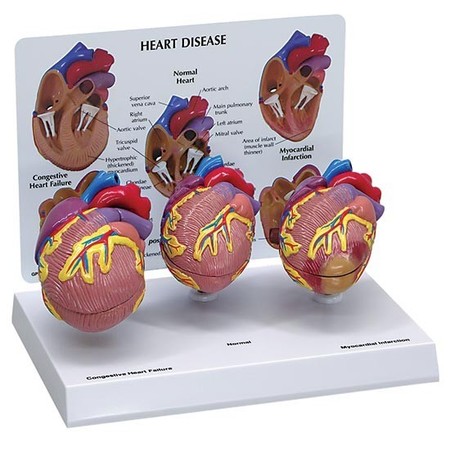 GPI ANATOMICAL Anatomical Model - 3-Piece Mini Heart 2550